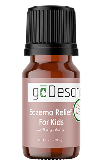 Eczema Relief For Kids Essential Oil Blend